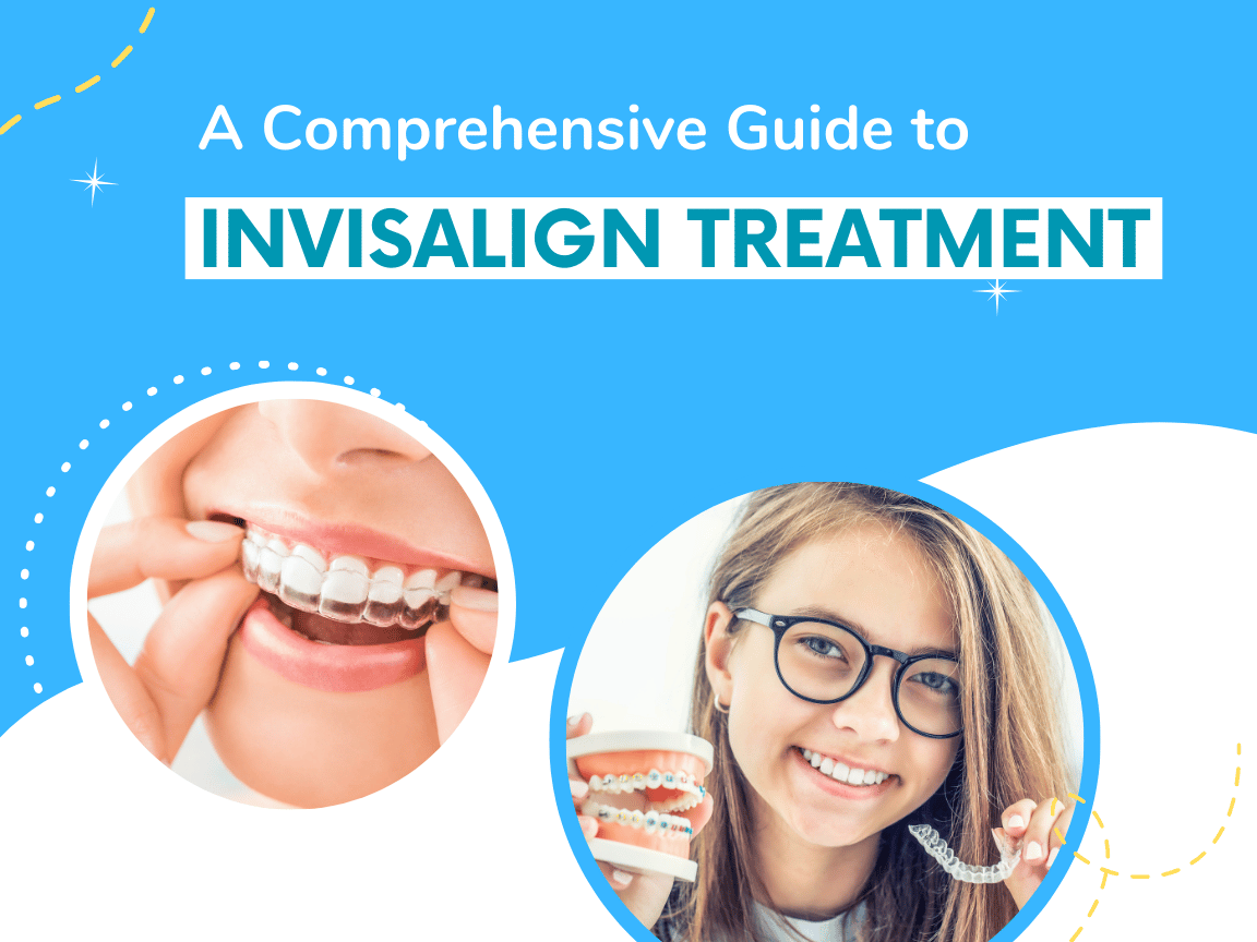 Read more about the article A Comprehensive Guide to Invisalign Treatment