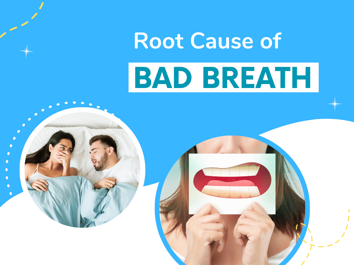 You are currently viewing The Root Causes of Bad Breath