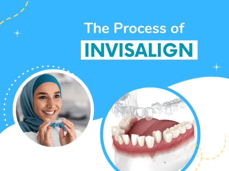 The Process of Invisalign Treatment_R Kaur Family Dentistry_Cambridge